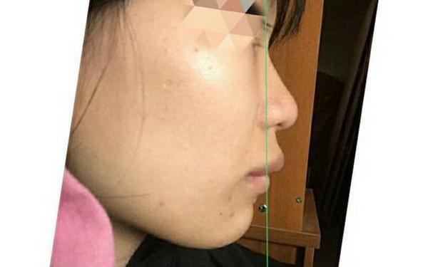 两眼外秃大嘴巴_嘴唇往外凸
